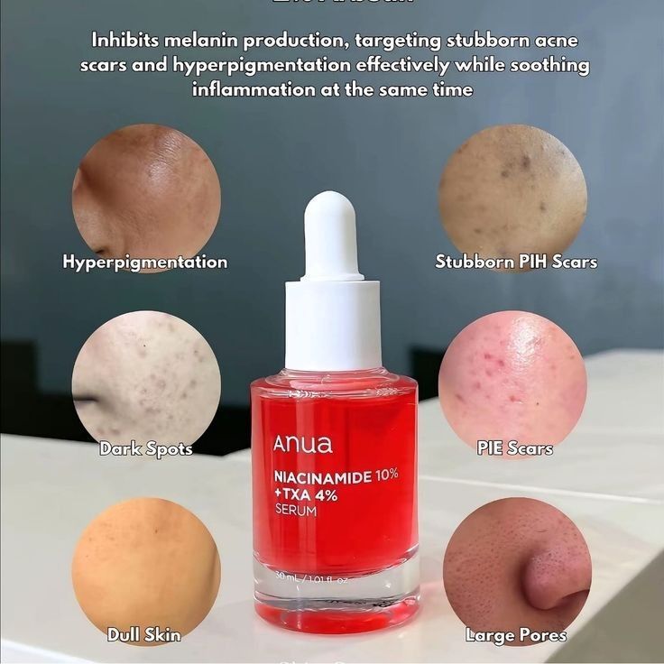 Anua Niacinamide 10% + TXA 4% Serum – 30ml